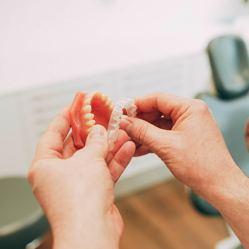Die unsichtbare Zahnschiene für Erwachsene aus Laupheim korrigiert Zähne unauffällig.