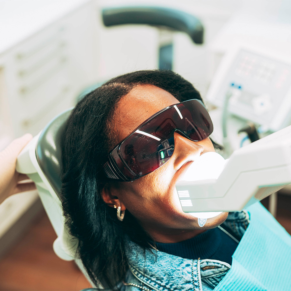 Patientin mit Zahnfleischschutz beim Zahnbleaching Laupheim.