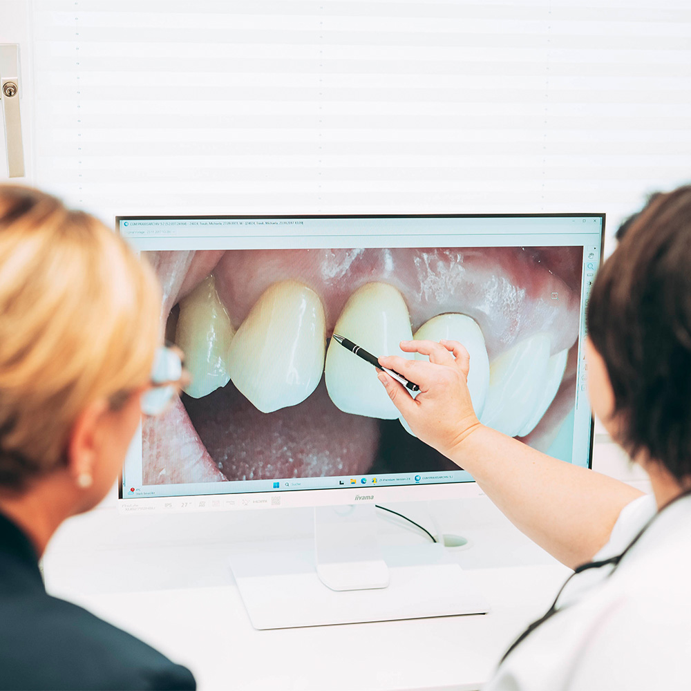 Zahnärztin zeigt die Anzeichen an einem Bildschirm für Parodontose