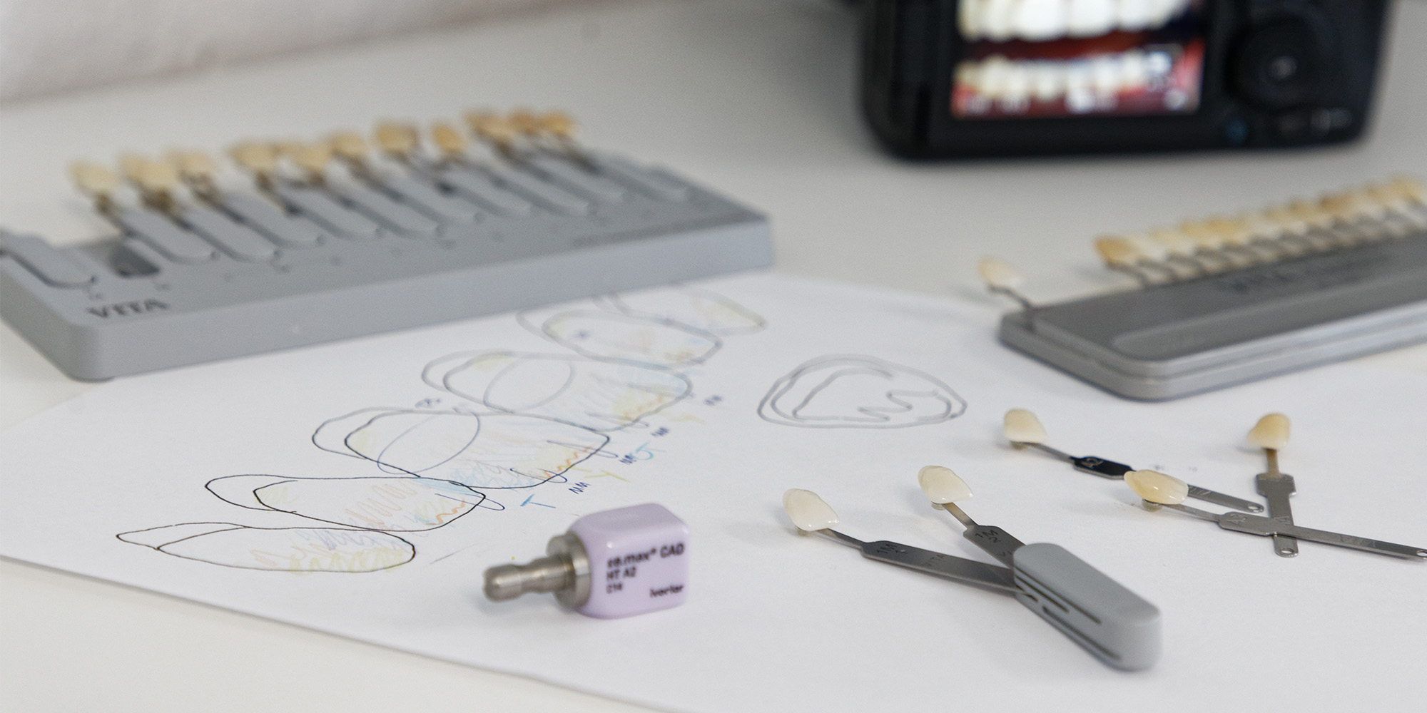 Tisch im Zahnlabor für Brücken und Zahnprothesen aus Laupheim glücklich und zufrieden.